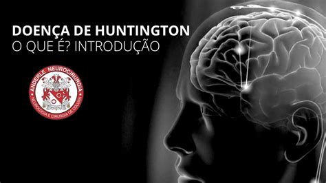 O Que é Doença De Huntington Introdução Dr Diogo Neurocirurgião