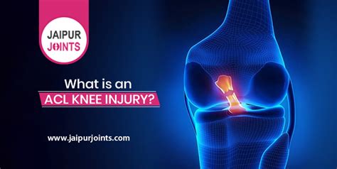 What is an ACL Knee Injury? | Dr. Lalit Modi