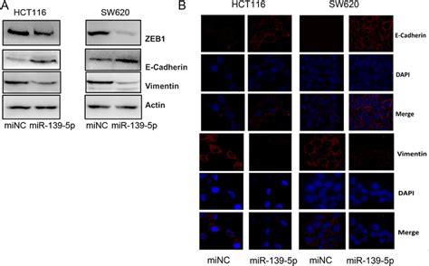 Mir P Inhibits The Epithelial Mesenchymal Transition In Colon