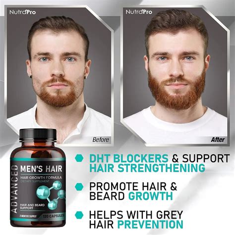 Men's Hair Growth Vitamins - Regrow Hair & Beard, Stop Hair Loss ...