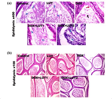 A B Representative Photomicrographs Of The Epididymis From Control