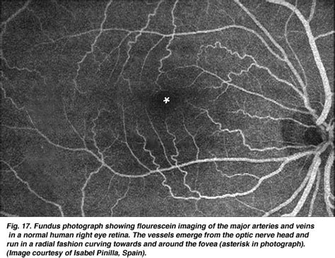 Simple Anatomy of the Retina by Helga Kolb – Webvision