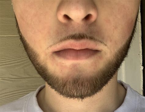 My Barber Screwed Up My Moustache What Should I Do Let It Continue To