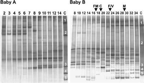 Representative Gels Of Dgge Analysis In A 37 Á 55 Denaturing Download Scientific Diagram