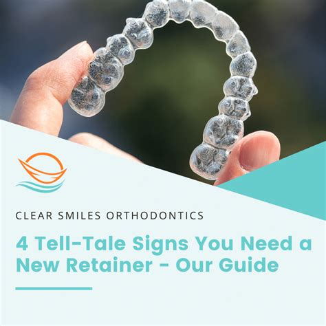 4 Tell Tale Signs You Need A New Retainer Our Guide Clear Smiles