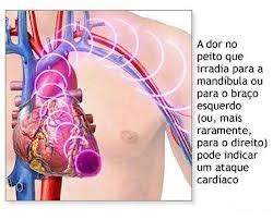 Consultoria de Enfermagem Mendes Hernandez Infarto O ataque Cardíaco