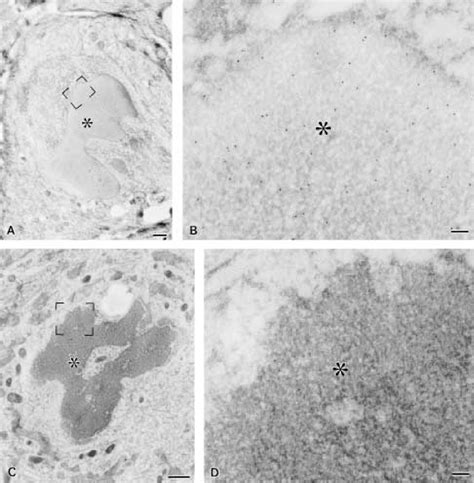 Figure 3 From Electron Microscopic In Situ DNA Nick End Labeling In