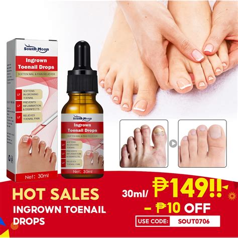 Hot Salesouth Moon Ingrown Toenail Drops Ml Soften Nail Pain