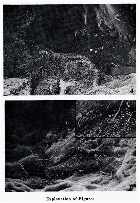 Figure 1 From Sex Difference And Fine Structure On Epithelium Cells Of Bowmans Capsule In Mice