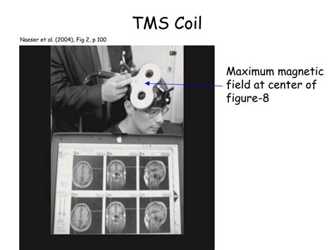 Ppt Transcranial Magnetic Stimulation Tms Powerpoint Presentation