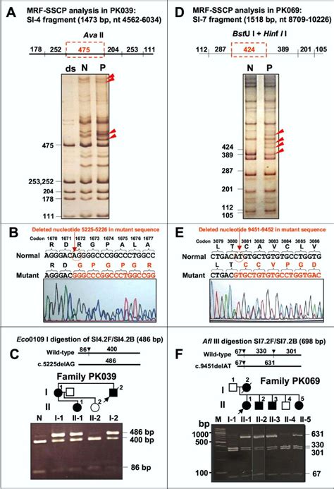 Novel And De Novo Pkd1 Mutations Identified By Multiple Restriction