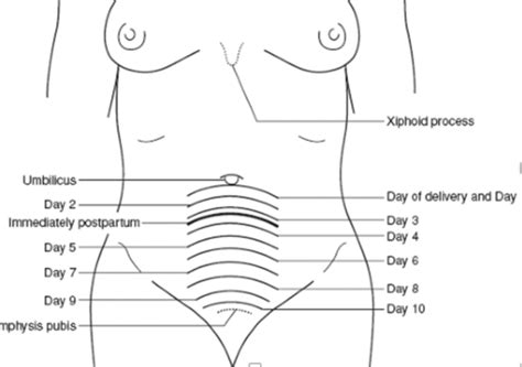 OB Exam Two PostPartum Flashcards Quizlet