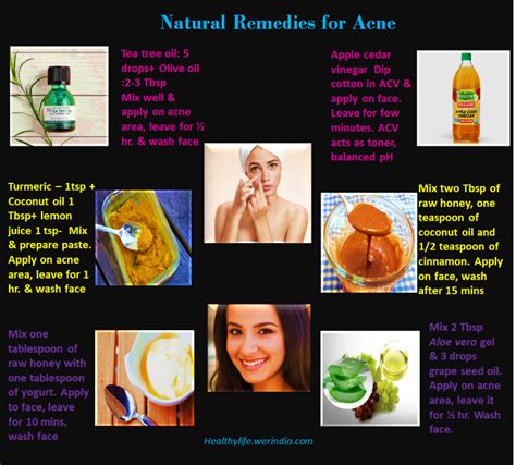 Natural Remedies for Acne - HealthyLife | WeRIndia