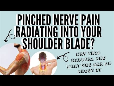 Pinched Nerve Pain Radiating Into Your Shoulder Blade Why This Happens