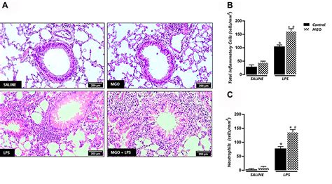 Methylglyoxal exacerbates LPS-induced ALI | JIR