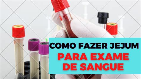 Jejum Para Exame De Sangue Por Que Fazer Como Fazer E Muito Mais