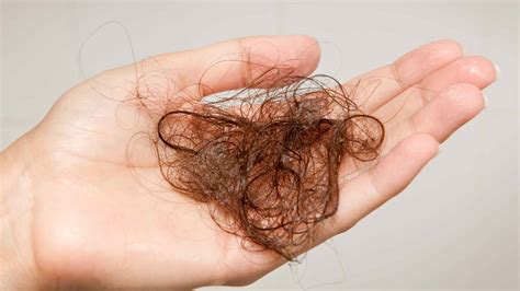 How Much Hair Loss Is Normal Brushing Washing And More 360hairloss