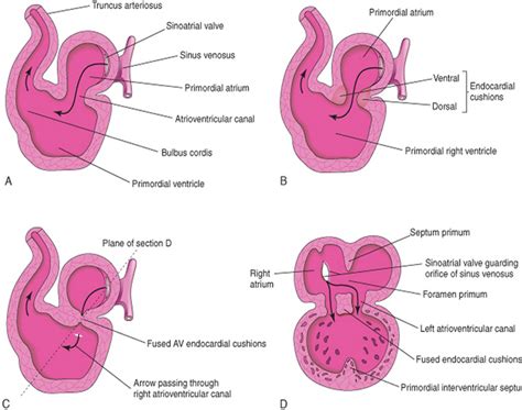 MBBS Medicine (Humanity First): Cardiovascular Embryology