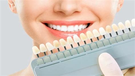 Mastering Teeth Whitening How This Cosmetic Dentistry Works And What