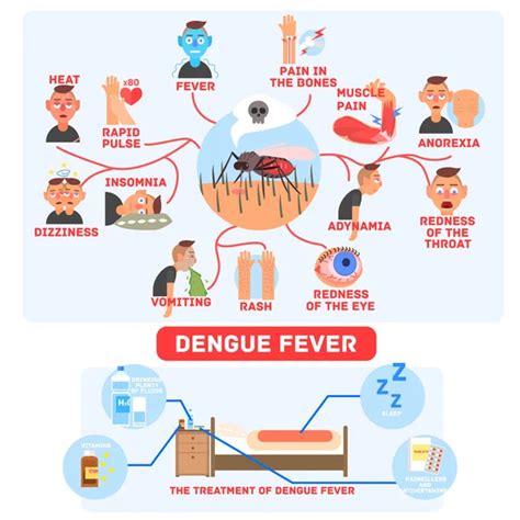 Dengue Fever Infographics Template Design Of Details Dengue Fev