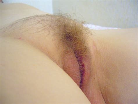 Buling Female Pubis Porn Photos Sex Pics