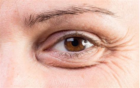 Thin Eyebrows Aesthetics Hq