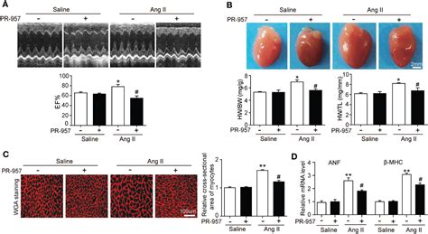 Frontiers Selective Inhibition Of The Immunoproteasome I Prevents