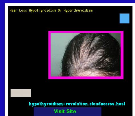 What Does Hypothyroidism Hair Loss Look Like Semi Short Haircuts For Men