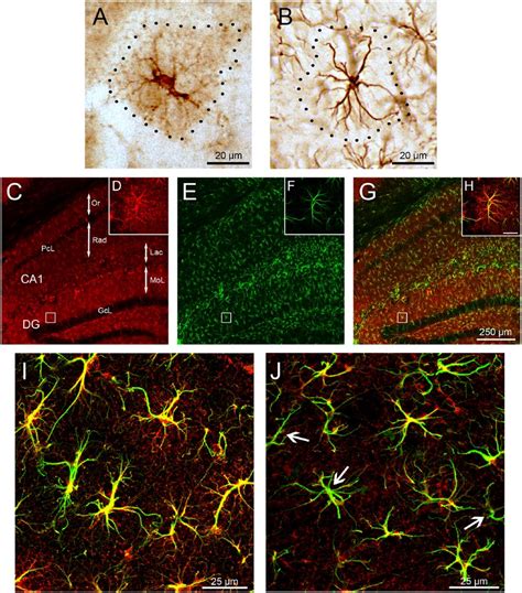 Down Regulation Of Glutamine Synthetase Gs Expression In Hippocampal