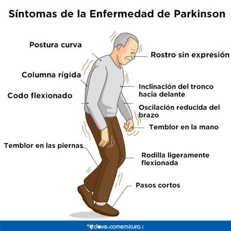 Síntomas cardinales de la enfermedad de Parkinson