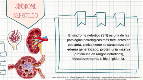 Síndrome Nefrótico y Nefrítico Anna Paola Benitez uDocz