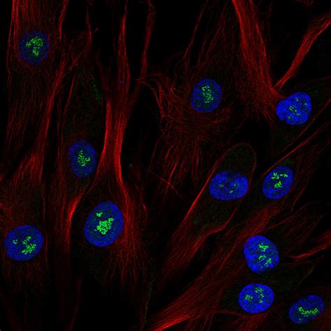 Subcellular Ggt The Human Protein Atlas