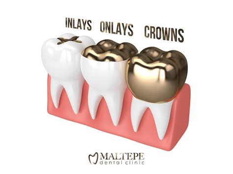 Denture Adhesives Types Top Brands And Choosing Factors