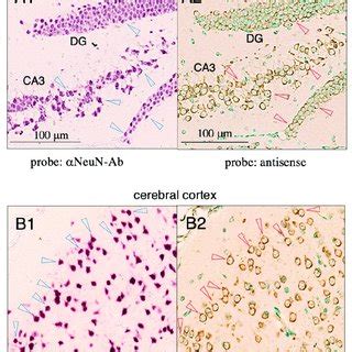 In Situ Hybridization Of Mouse Cortex And Hippocampus Using A