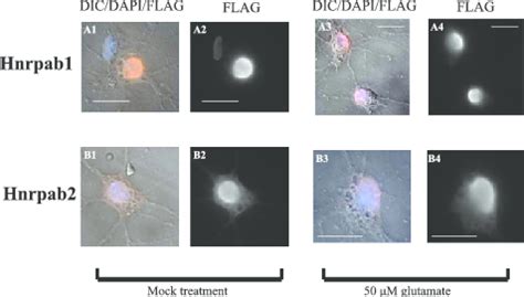 Hnrpab Isoforms Appear In The Cytoplasm Of Mature Neurons Primary