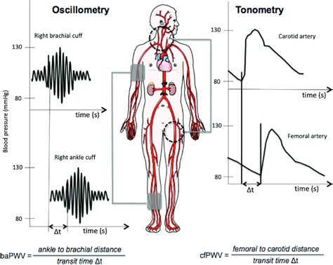 Brachial Pulse