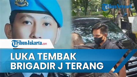 Komnas HAM Pastikan Luka Di Tubuh Brigadir J Sudah Terang Benderang