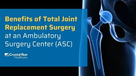 Ppt Benefits Of Total Joint Replacement Surgery Powerpoint