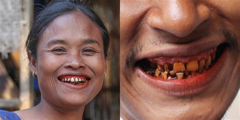 Betel Nut Chewing With Lime And Tobacco Is Part Of Northeast Indias