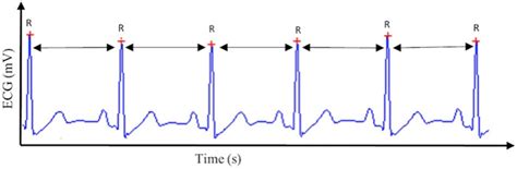 Frontiers Heart Rate Variability And Cardiac Vagal Tone In