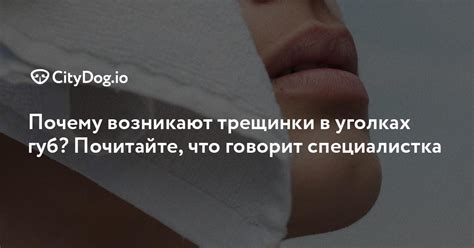 Заеды: почему возникают и чем лечить? - CityDog.io