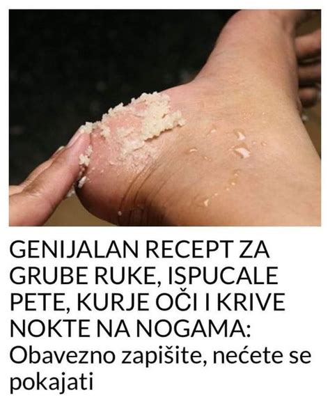 GENIJALAN RECEPT ZA GRUBE RUKE ISPUCALE PETE KURJE OČI I KRIVE NOKTE