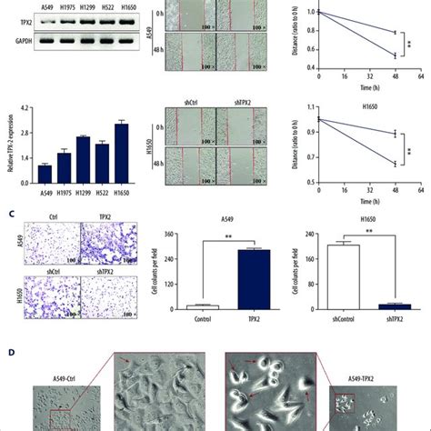 TPX2 Affected NSCLC Migration Invasion And Cell Replasticity A