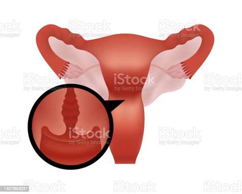 Realistic Illustration Of Female Human Reproductive System On White