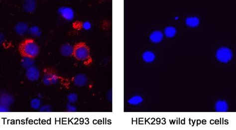 Sars Cov Spike Rbd Antibody Mab Bio Techne