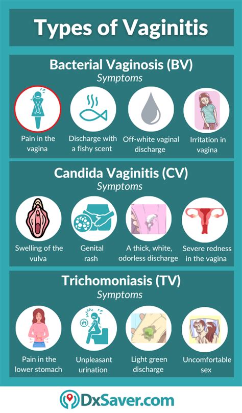 Vaginitis Test Symptoms Causes Vaginal Health And Vaginitis Testing