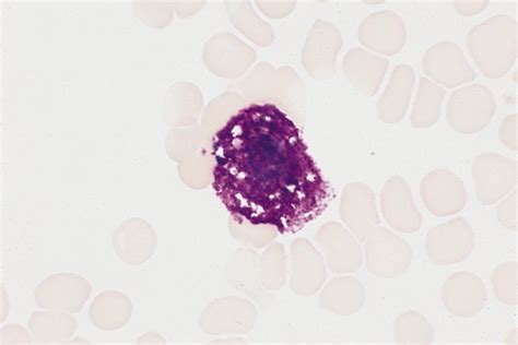 Mast Cell Histology