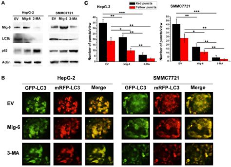 Mig Enhances Autophagy In Hcc Cells A Western Bloting Analysis