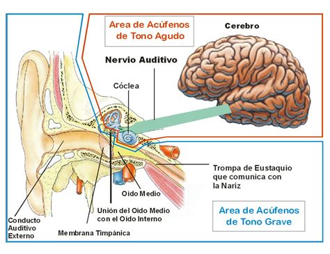 El profesor Bigotini TINNITUS O ACÚFENOS MUCHO RUIDO Y POCAS NUECES