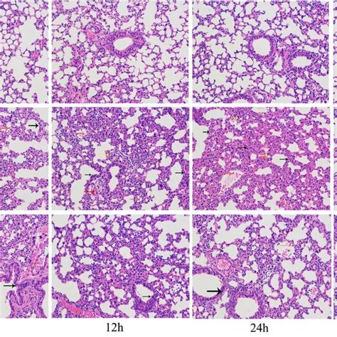 Effects Of H2 Treatment On Histological Changes In Lung Of LPS Induced